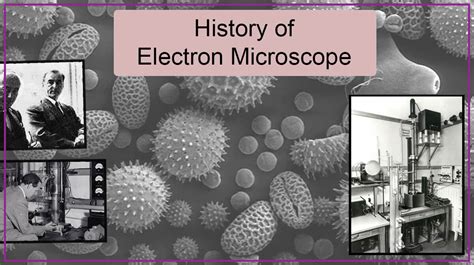transmission electron microscopy history.
